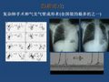 胸外科在国内的地位与我院肺外科进展