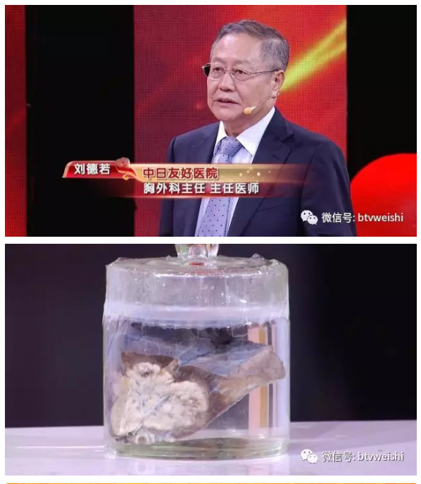 QQ图片20170818142141.png